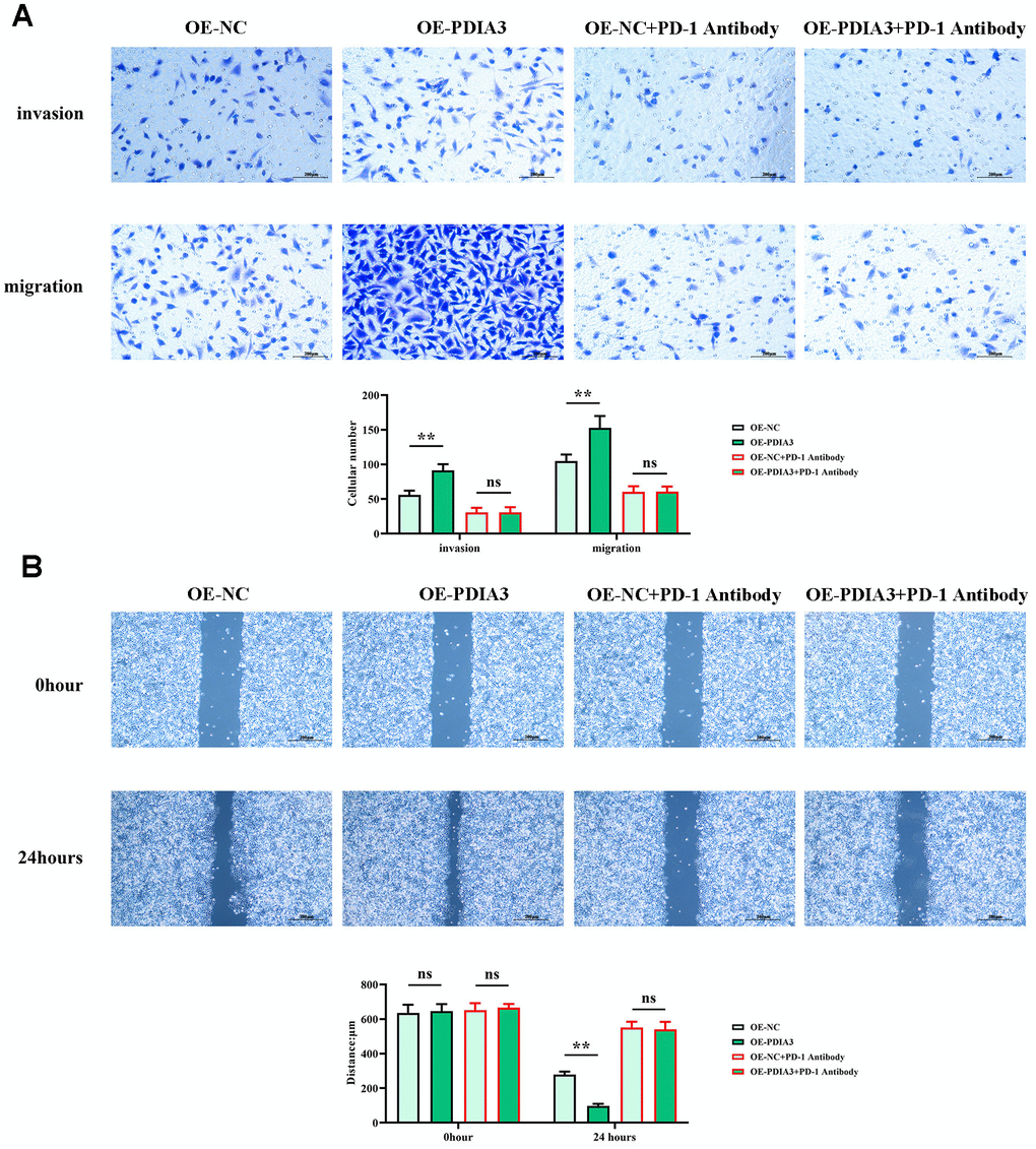 PDIA3 enhances the migratory capacity of CRC cells through the regulation of STAT3/PD-1 signaling, along with influencing tumor-associated macrophage M2 polarization and tissue protease secretion. (A) Transwell migration and invasion assay results for SW480 cells, with comparative analysis between PDIA3 overexpression and OE-NC control, and PD-1 inhibitor and PD-1 NC treatments (n=3 per group, magnification 200x). Statistical evaluation via T-test,* *P B) Wound healing assay results depicting cellular migration over 24 hours between SW480 cells with PDIA3 overexpression versus or-NC control, and PD-1 inhibitor versus PD-1 NC treatments (n=3 per group, magnification 200x). Statistical evaluation via T-test,* *P 