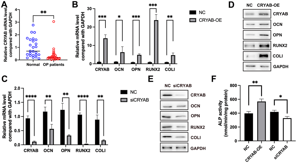 CRYAB positively regulates the osteogenic differentiation of BMSCs. (A) mRNA expression level of CRYAB in osteoporosis samples was detected using qRT-PCR. (B, C) mRNA expression levels of CRYAB, OCN, OPN, RUNX2, and COLI when CRYAB was overexpressed or silenced were detected using qRT-PCR (n=3). (D, E) Protein expression levels of CRYAB, OCN, OPN, RUNX2, and COLI when CRYAB was overexpressed or silenced were detected using the Western blotting method (n=3). (F) The activity of ALP was detected using an Alkaline Phosphatase Assay Kit (n=3). *: p p p p 