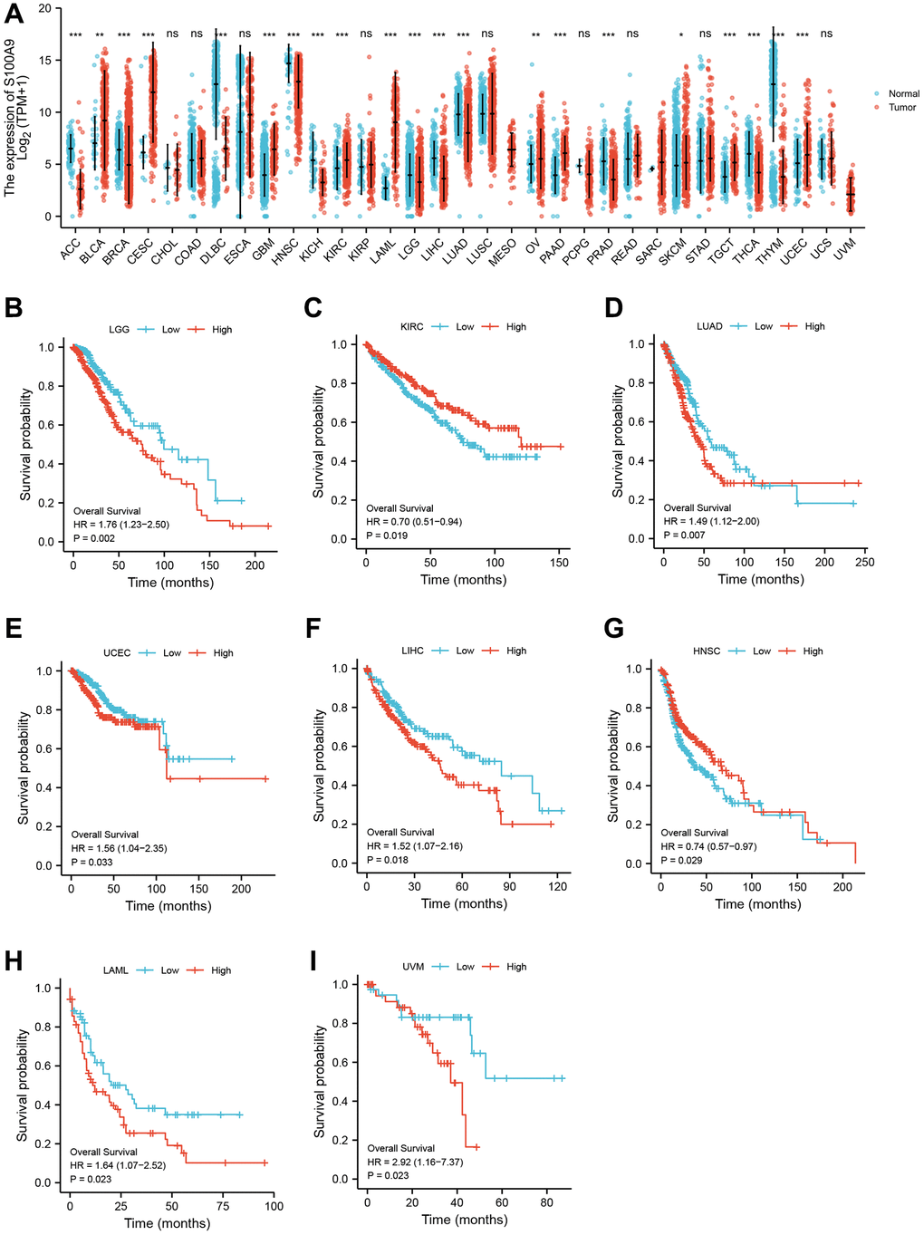 Pan-cancer analysis showed that S100A9 was highly expressed in most tumors (A) and its effect on prognosis (B–I).