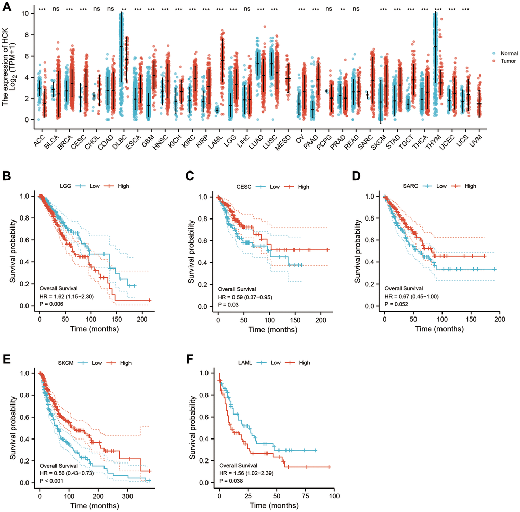 Pan-cancer analysis showed that HCK was highly expressed in most tumors (A) and its effect on prognosis (B–F).