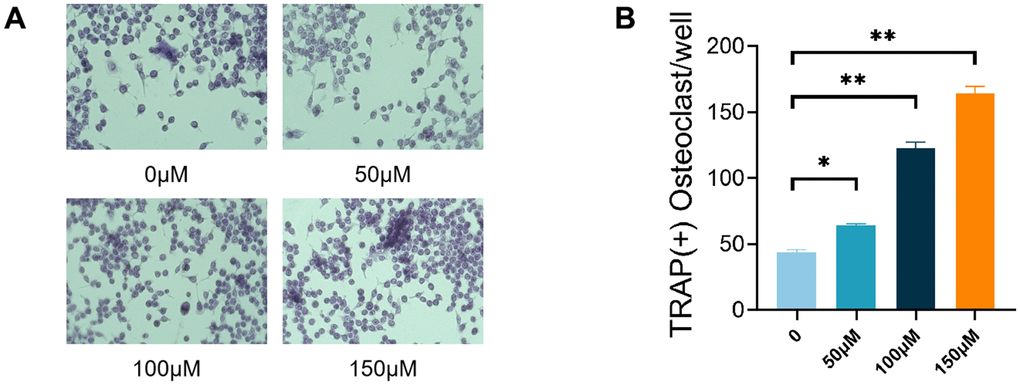 TMAO promoted RANKL-induced osteoclast differentiation. (A) RAW 264.7 cells were cultured for 4 d with RANKL (50 ng/mL) and M-CSF (10 ng/mL) in the presence of varying concentrations of TMAO and then stained for TRAP activity. Representative photomicrographs were taken under a light microscope (magnification ×40). (B) TRAP-positive cells containing more than three nuclei were counted as osteoclasts; ** p 
