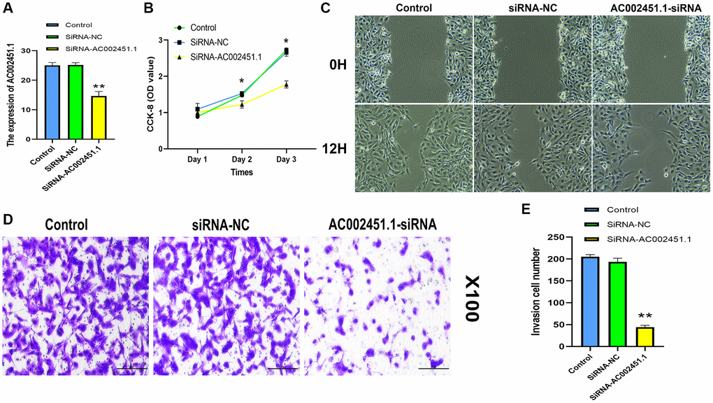 Assessment of biological function for AC002451.1. (A) RT-PCR validation following AC002451.1 knockdown in OSRC2 cells. (B) CCK-8 assay was performed to determine the proliferation ability of OSRC2 cells after AC002451.1 knockdown. (C) A wound healing assay was used to assess the migration ability of cells following AC002451.1 knockdown. (D, E) Transwell assay was used to assess the migration ability of cell lines following AC002451.1 knockdown. *p *p **p *p 