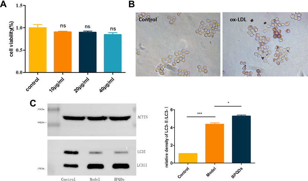 Results of the mechanism of black phosphorus quantum dots in preventing atherosclerosis. (A) In vitro safety assessment of CCK8. (B) Oil red O staining of RAW264.7 cells after ox-LDL induced foam cells (20). (C) Expression of autophagy protein LC3 detected by western blot.