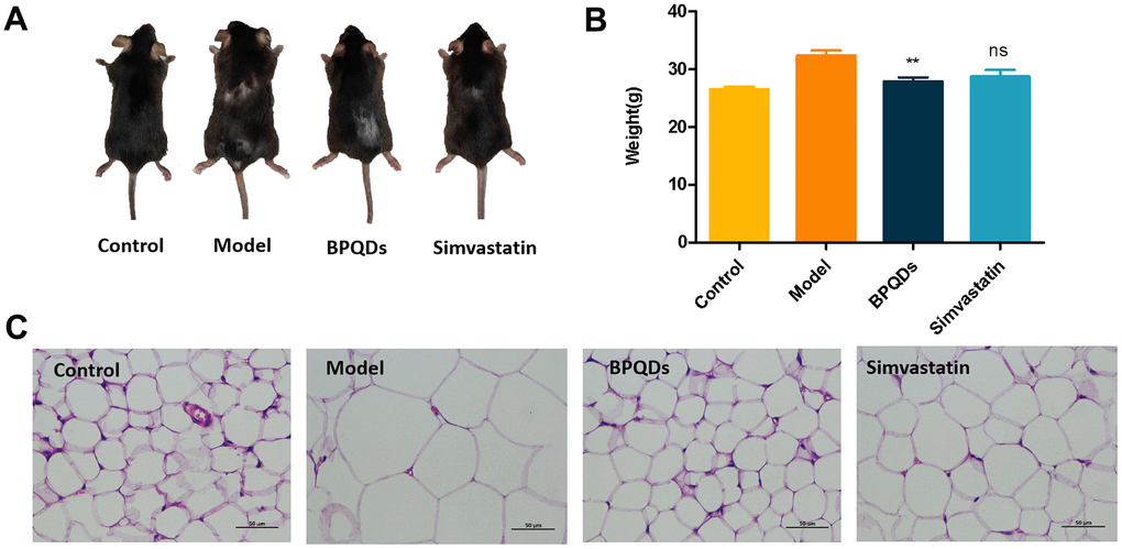 Effect of black phosphorus quantum dots on weight loss after 12 weeks of preventive administration. (A) Comparison of body size of mice in each group. (B) Comparison of body weight of mice in each group; statistical analysis results were obtained by comparison with the model group. (C) HE staining of visceral cells of mice in each group (400×).