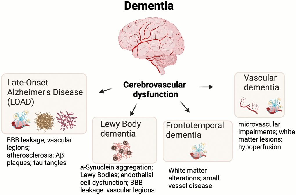 Cerebrovascular dysfunction is an underlying feature of most major types of dementia. Additional and key hallmarks are shown for each dementia subtype. Abbreviations: BBB=blood brain barrier; Aβ=Amyloid beta.