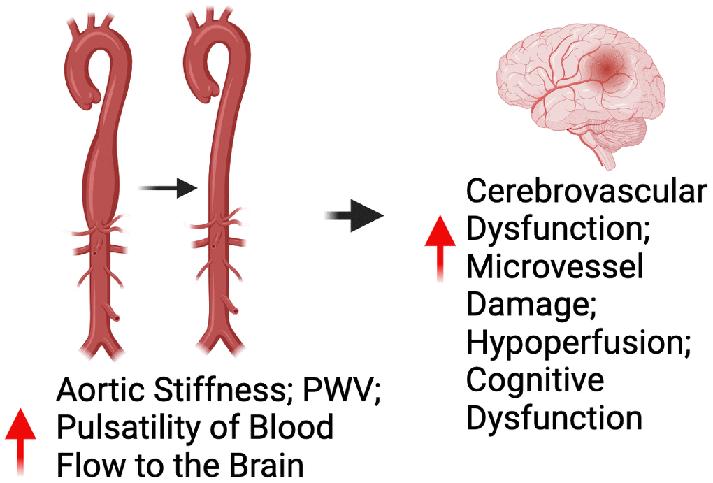 Relationship between peripheral vascular dysfunction and brain health. Abbreviations: PWV=pulse wave velocity.