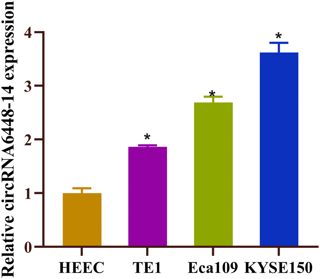 High expression of circRNA6448-14 in ESCC. Expression of circRNA6448-14 in normal esophageal epithelial cell HEEC and ESCC cells TE1, Eca109, KYSE150. *P 