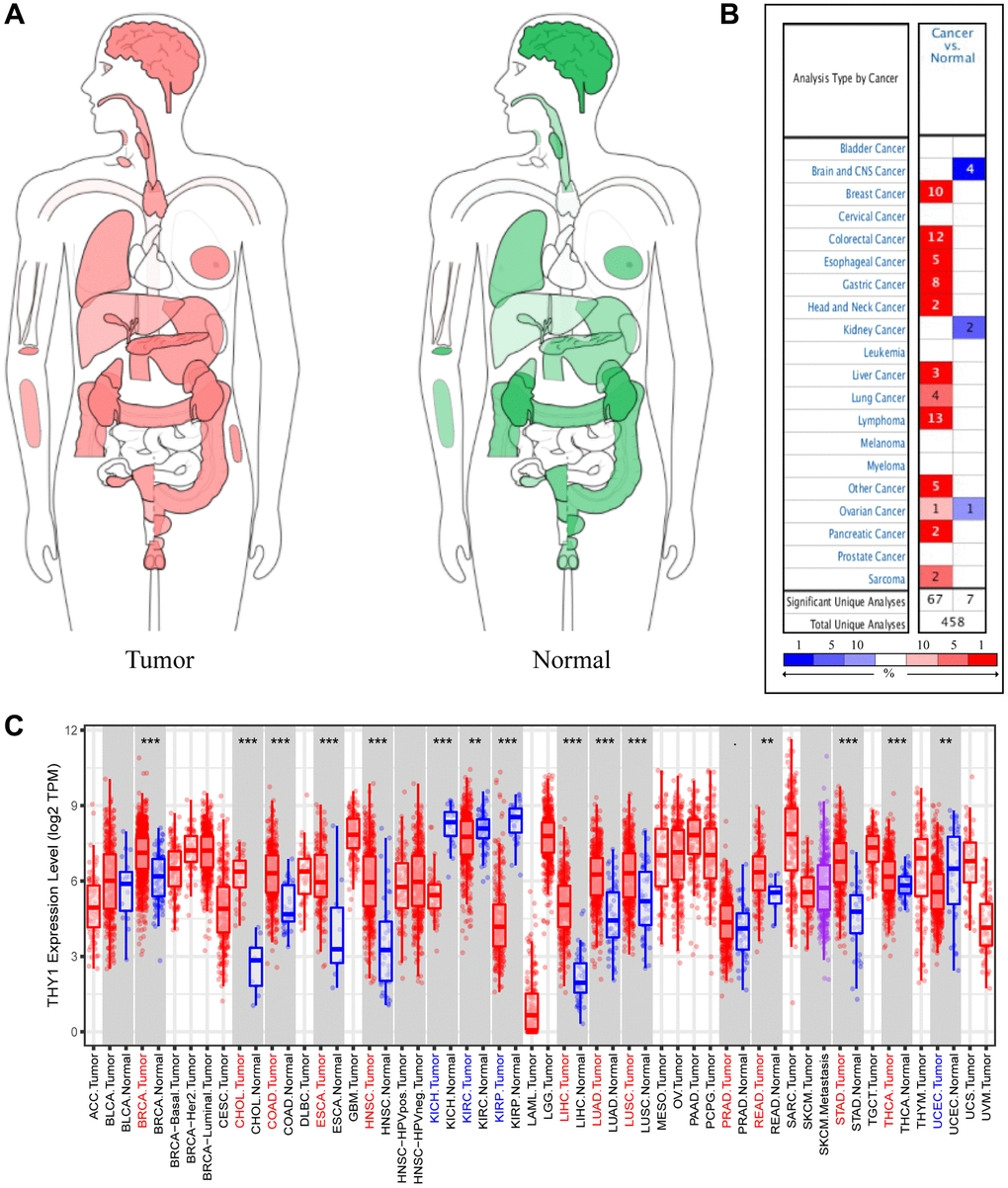 Differentially expressed THY1 in a variety of cancers and normal tissues. (A) The interactive body-map revealed the median expression of THY1 in tumor (red) and normal samples (green) using GEPIA (scale: Log2 (TPM+1)). (B) The expression levels of THY1 in different tumors compared to normal tissues from ONCOMINE database. (C) The expression levels of THY1 in 33 types of cancers compared to normal tissues from TCGA in TIMER database.