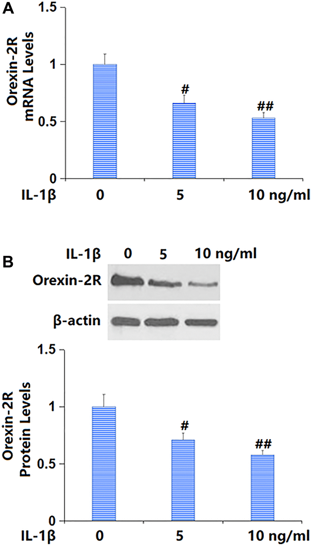 Exposure to IL-1β reduced the expression of orexin-2 receptor (orexin-2R) in TC-28a2 chondrocytes in a dose-dependent manner. Cells were stimulated with IL-1β (5, 10 ng/ml) for 24 hours. (A) mRNA levels of orexin-2R; (B) Protein levels of orexin-2R (#, ##P n = 6).