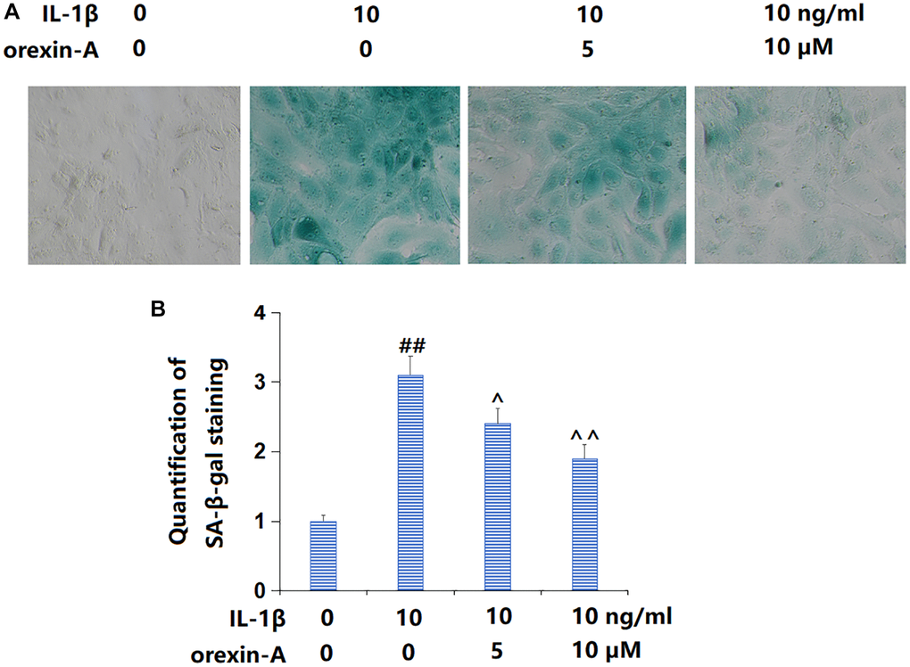 Treatment with orexin-A ameliorated IL-1β-induced cellular senescence. Cells were stimulated with IL-1β (10 ng/ml) with or without orexin-A (5 and 10 μM) for 14 days, cellular senescence was measured using senescence-associated β-galactosidase (SA-β-gal) staining. (A) Representative images of SA-β-gal staining; (B) Quantification of SA-β-gal staining (##P ^, ^^P n = 5).