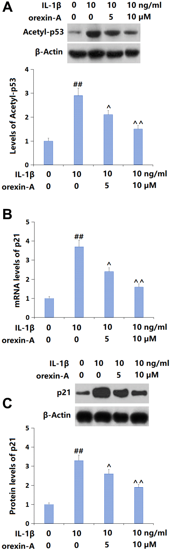 Treatment with orexin-A prevented IL-1β-induced activation of the p53/p21 axis. Cells were stimulated with IL-1β (10 ng/ml) with or without orexin-A (5 and 10 μM). (A) The levels of Acetyl-p53; (B) The mRNA levels of p21; (C) The protein levels of p21 (##P ^, ^^P n = 5).