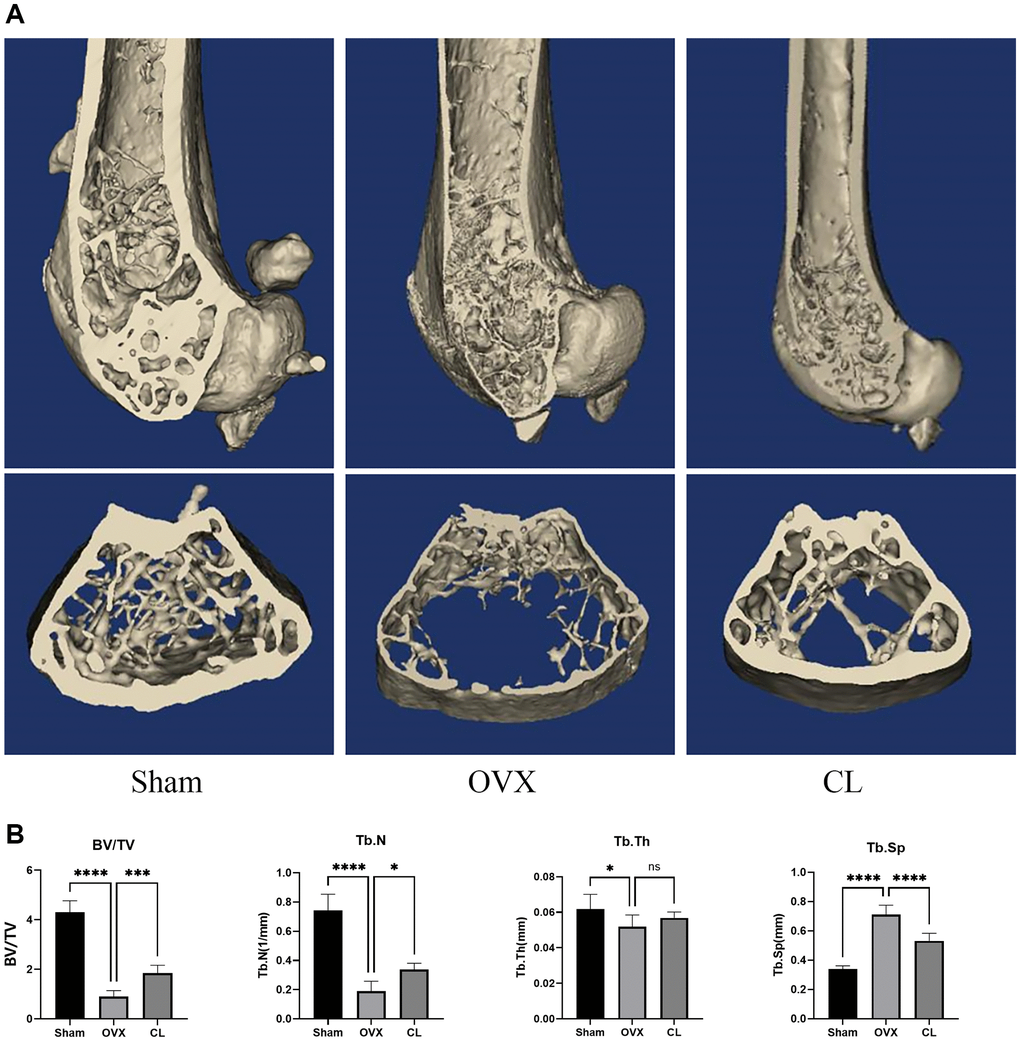 Inhibition of OVX-induced bone loss by CL administration. (A) The 3D reconstruction image from bone samples. (B) The quantifying analysis of bone quality through BV/TV, Tb.Th, Tb.N, and Tb.Sp. The ns, not statistically significant; *P ***P ****P 