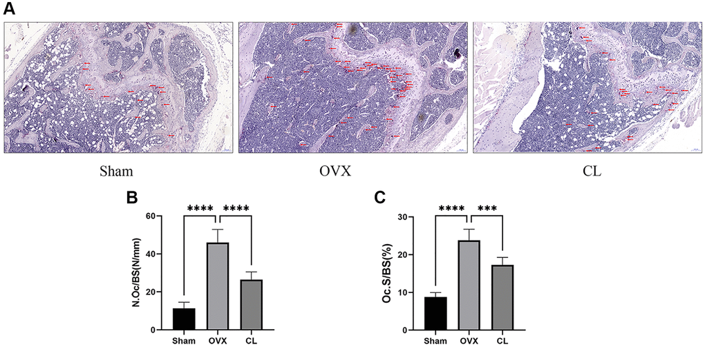 Inhibition of osteoclast formation in vivo by CL administration. (A) The TRAP staining image from bone samples. (B, C) The histomorphometric quantifying (N.Oc/BS and OcS/BS) of TRAP-positive osteoclasts. ***P ****P 