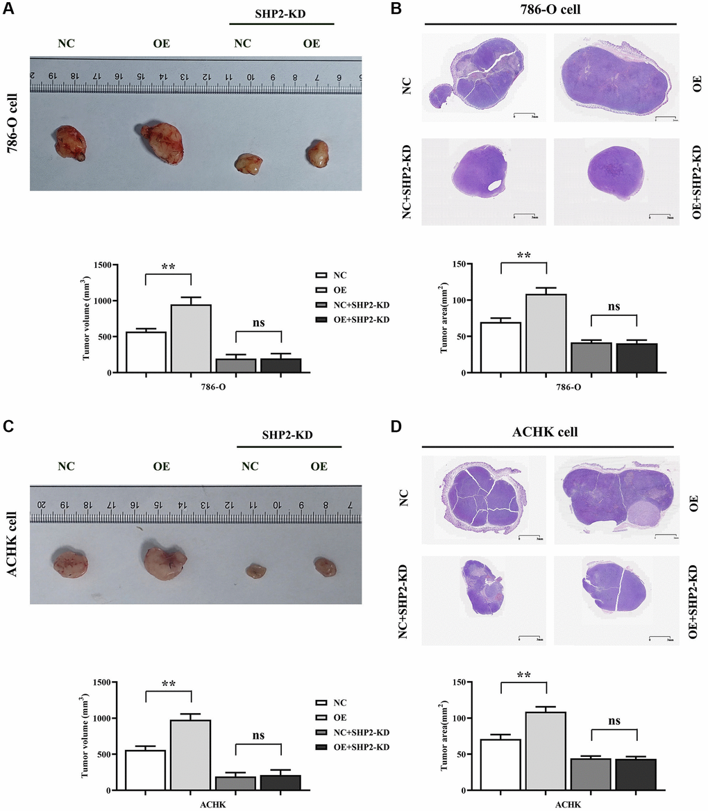 Specific inhibition of RGC32 can inhibit the progression of ccRCC. (A) Results of tumor-bearing experiments and tumor volume statistics of 786-O cell nude mice; (B) The results of HE experiments in 786-O cells and the statistics of tumor slice area; (C) Results of tumor-bearing experiments and tumor volume statistics of ACHN cell nude mice; (D) The results of HE experiments in ACHN cells and the statistics of tumor slice area. **p nsp > 0.05.