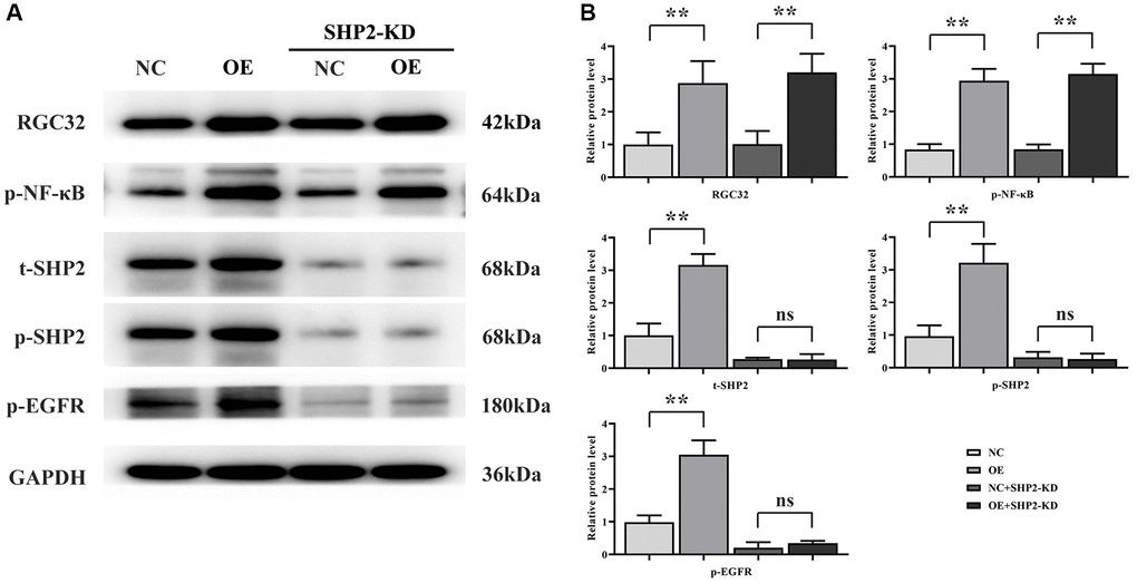 RGC32 can promote phosphorylation of NF-κB, SHP2 and EGFR. (A) Band plots of protein expression for RGC32, p-NF-κB, p-SHP2, t-SHP2 and p-EGFR; (B) Relative protein expressions of RGC32, p-NF-κB, p-SHP2, t-SHP2 and p-EGFR. **p nsp > 0.05.