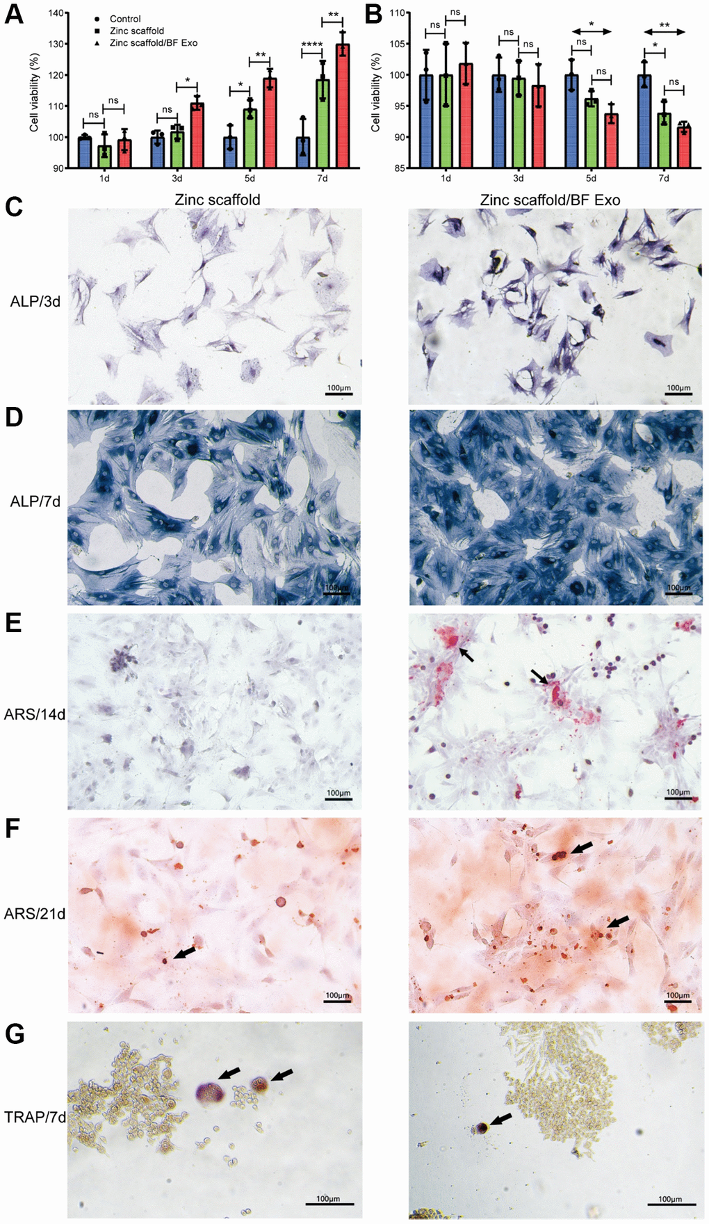 In vitro osteogenic performance assessment of zinc scaffold/BF Exo composite implant. (A) The CCK-8 experiment was used to measure the cell viability of BMSCs after osteogenic induction for 1, 3, 5, and 7 days; (B) The CCK-8 experiment was used to assess the cell viability of RAW264.7 cells after osteoclast induction for the same time periods; (C, D) ALP staining was conducted for BMSCs after 3 and 7 days of osteogenic induction, where darker staining indicated stronger positive expression; (E, F) Alizarin Red staining was performed for BMSCs after 14 and 21 days of osteogenic induction; (G) TRAP staining was conducted for RAW264.7 cells after 7 days of osteoclast induction (*P **P ****P P > 0.05, n = 3).