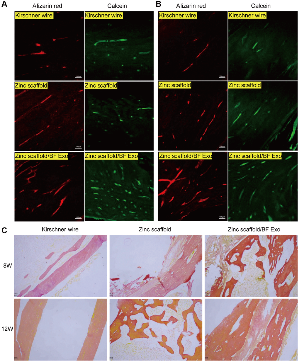 Fluorescence and staining experiments on rabbit radius bones. (A) Alizarin Red and Calcein Green fluorescence results of rabbit radius tissues after 8 weeks of modeling in each group; (B) Alizarin Red and Calcein Green fluorescence results of rabbit radius tissues after 12 weeks of modeling in each group; (C) Methylene blue-acidic magenta staining results of rabbit radius tissues after 8 and 12 weeks of modeling in each group (100×, n = 3).