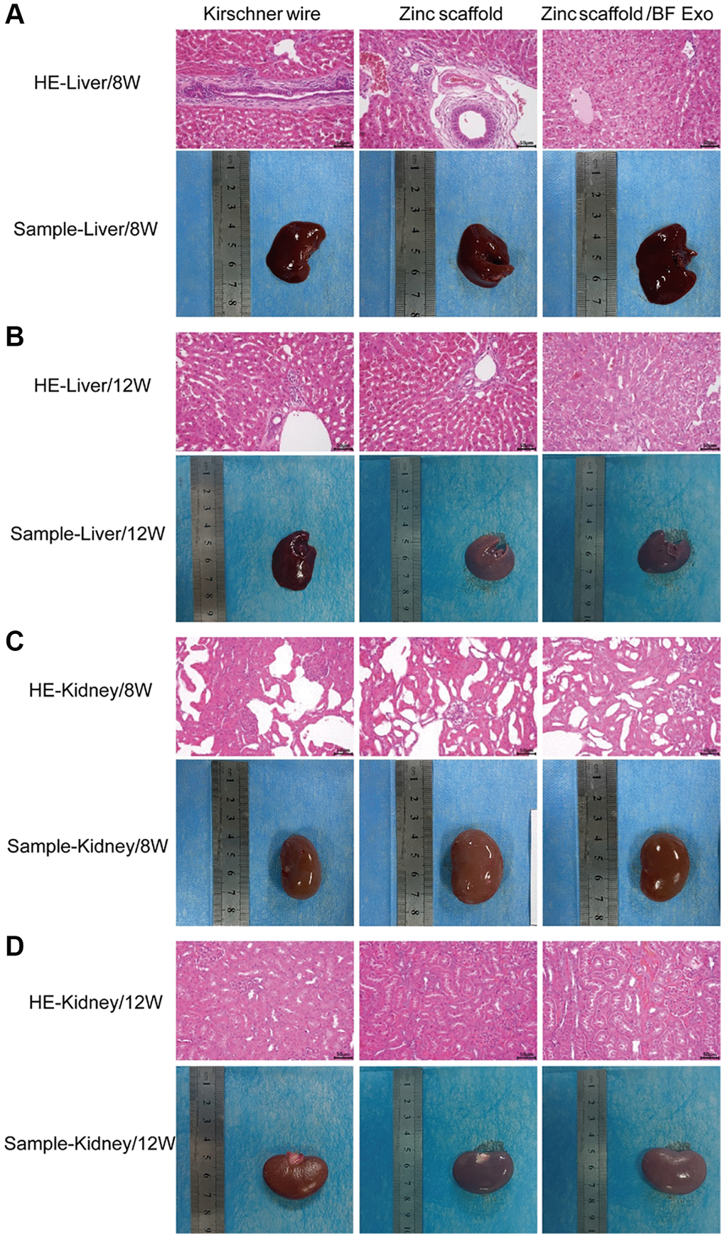 Assessment of in vivo hepatorenal toxicity of zinc scaffold/BF Exo composite implant. (A) HE staining results and physical samples of rabbit liver tissue after 8 weeks of modeling by each group; (B) HE staining results and physical samples of rabbit liver tissue after 12 weeks of modeling by each group; (C) HE staining results and physical samples of rabbit kidney tissue after 8 weeks of modeling by each group; (D) HE staining results and physical samples of rabbit kidney tissue after 12 weeks of modeling by each group (200×, n=3).