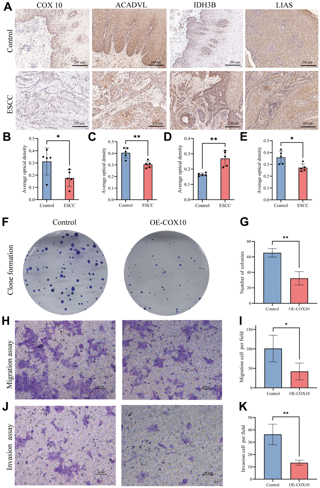 The expression of MMRGs and the role of COX10 protein in ESCC. (A) Representative image of the IHC staining of COX10, ACADVL, IDH3B and LIAS. (B–E) Quantitative statistics of the expression of COX10 (B), ACADVL (C), IDH3B (D) and LIAS (E). (F) Colony formation of ESCC cells transfected with COX10 or vector. (G) Quantitative statistics of the Colonies. (H) The migration ability of ESCC cells transfected with COX10 or vector. (I) Quantitative statistics of the migration cells per field. (J) The invasion ability in ESCC cells transfected with COX10 or vector. (K) Quantitative statistics of the invasion cells per field. Each experiment was repeated three times independently, and * stands for PP