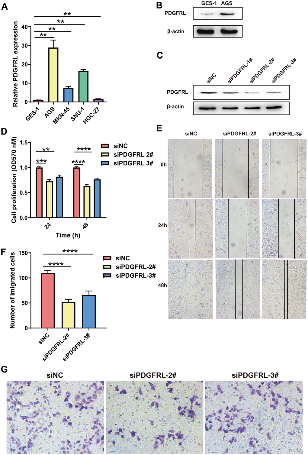 Functional validation for PDGFRL in GC cells. (A) PDGFRL mRNA expressions in normal gastric cells GES-1 and GC cells AGS, MKN-45, SUN-1 and HGC-27. (B) PDGFRL protein expressions in GES-1 and AGS cells. (C) AGS cells were transiently transfected with three different PDGFRL siRNAs (siPDGFRL-1#, siPDGFRL-2# and siPDGFRL-3#) and their negative control (siNC). Western blot was used to measure PDGFRL expressions. β-actin was used as loading control. MTT assay (D), wound healing assay (E) and transwell assay (F) were used to measure proliferation, migration and invasion of AGS cells, respectively. Representative images of the transwell assay were shown (G). The data were presented as the mean ± standard deviation. *** P P P 
