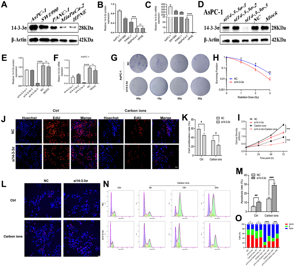 Knockdown of 14-3-3σ sensitizes PAAD cells. The level of 14-3-3σ expression in PAAD cell lines (AsPC-1, SW1990, PANC-1, MiaPaCa-2) was detected by immunoblotting (A, B) and qPCR (C). The protein and mRNA levels of 14-3-3σ in AsPC-1 cells with 14-3-3σ-specific small interfering RNA (siRNA) were detected by immunoblotting (D, E) and qPCR (F). (G, H) Colony formation assays and survival fraction curves of AsPC-1 cells after exposure to the indicated carbon ion irradiation dose (1 Gy, 2 Gy, and 3 Gy). (I) Cell proliferation of AsPC-1 cells in different groups after 3Gy carbon ion irradiation was determined by CCK-8 assay at 24 h, 48 h, and 72 h. (J, K) The proliferation of AsPC-1 cells was detected by EdU assay. Scale bar = 100 μm. (L, M) The apoptosis rate of AsPC-1 cells after 3 Gy carbon ion irradiation at 24 h in different groups. Scale bar = 10 μm. (N, O) The cell cycle distribution of AsPC-1 cells after 3 Gy carbon ion irradiation at 6 h, 12 h, and 24 h in different groups. β-Actin was used as a loading control. Data were presented as the mean ± standard deviation (SD) (n=3); *p p p p 