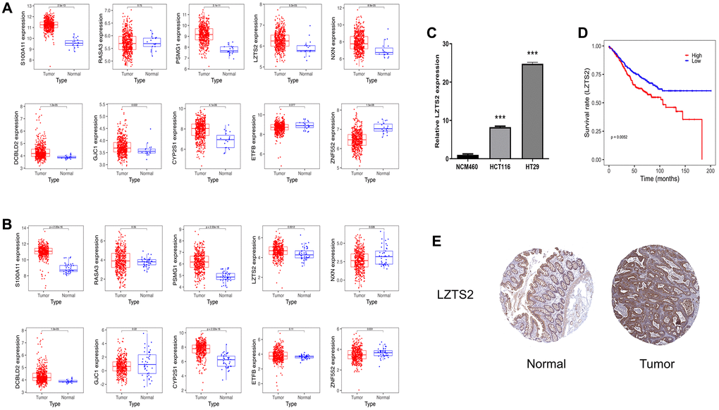 Identification of LSZT2 mRNA expression. (A) The expressions of ten genes in discovery cohorts. (B) The expression of ten genes in validation cohorts. (C) The LSZT2 expression level in NCM460 cells and CC cell lines. (D) The prognostic analysis of LSZT2 in CC patients. (E) IHC staining of LSZT2 in normal and CC tissues from the HPA database.