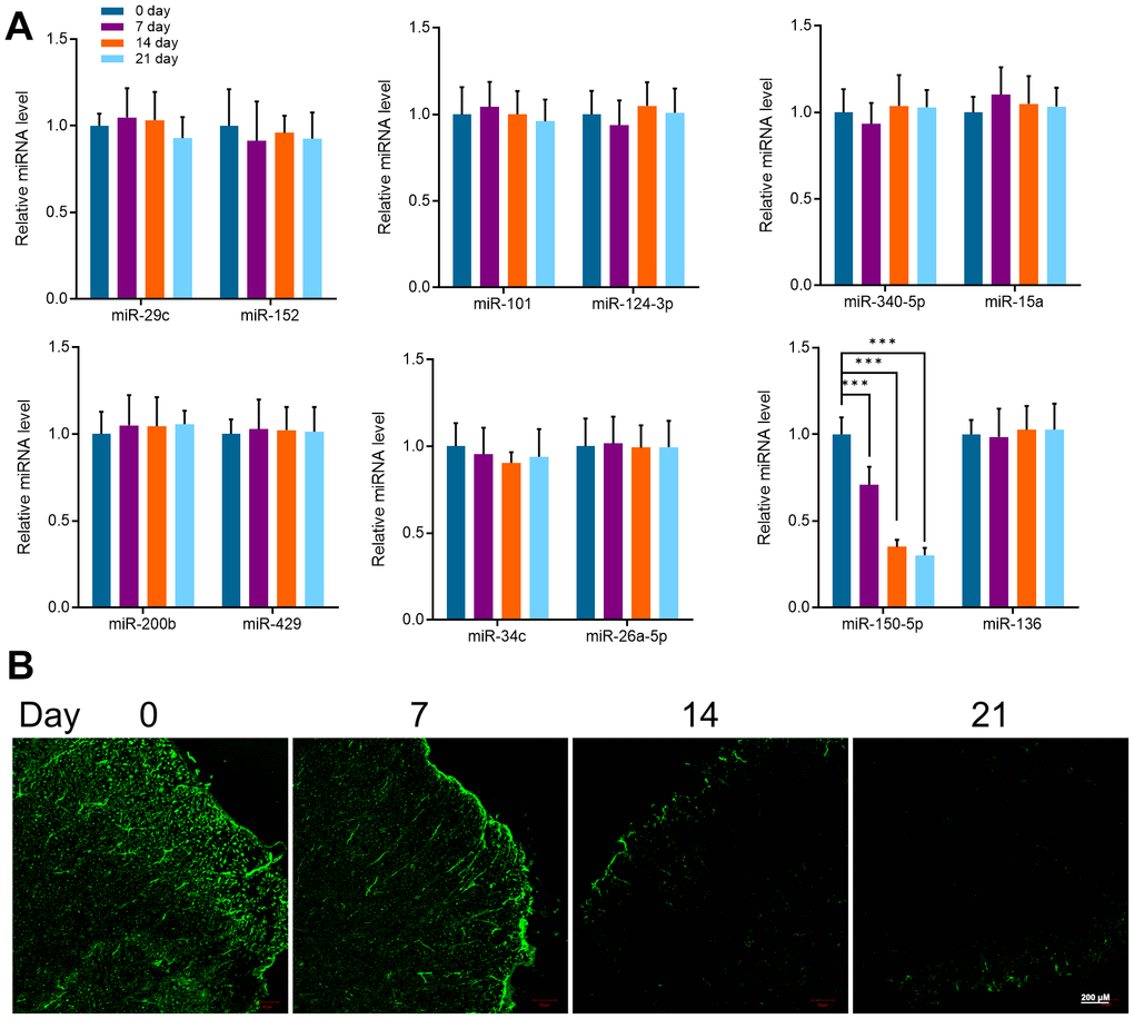 (A) qRT-PCR detected the expression of miR-29c, miR-152, miR-101, miR-124-3p, miR-340-5p, miR-15a, miR-200b, miR-429, miR-34c, miR-26a-5p, miR-150- 5p and miR-136 in mice spinal cord at different periods (0, 7, 14, and 21 days). (B) FISH detected the expression of miR-150-5p in the spinal cord of mice at different periods (0, 7, 14, and 21 days). Values were expressed as means ± SEM, n=8, *** P