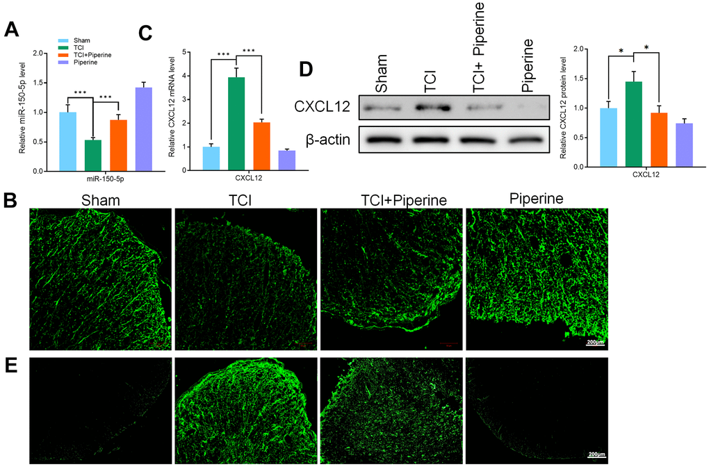 (A) qRT-PCR detected the expression of miR-150-50p in the spinal cord of all mice. (B) FISH detected the miR-150-50p expression in the spinal cord of mice. (C) qRT-PCR detected the CXCL12 expression in the spinal cord of mice. (D) Western blot detected CXCL12 protein expression in the spinal cord of mice. (E) Immunofluorescence detected CXCL12 protein expression in the spinal cord of mice. Values were expressed as means ± SEM, n=8, ** PP