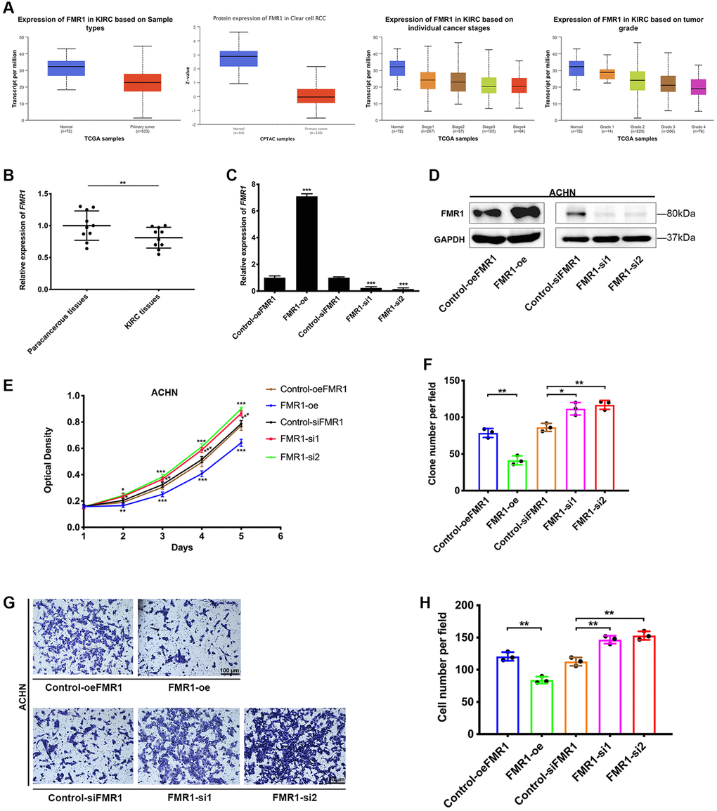 Protective effect of FMR1 in KIRC. (A) The expressing level of FMR1 in KIRC and normal tissues. (B) The qRT-PCR detects FMR1 expression of paired paracancerous tissues and KIRC cancer tissues from Zhongnan Hospital. (C) Overexpression and knockdown efficiency in ACHN cells. (D) WB confirmed the overexpression and knockdown of FMR1 in ACHN cells. (E) MTT assay to investigate the proliferation of ACHN cells. (F) Clonogenic formation results from three independent experiments. (G) Transwell migration assay to investigate cell migration ability, scale bar = 100 μm. (H) Confirmed by statistical analysis. *p **p ***p 