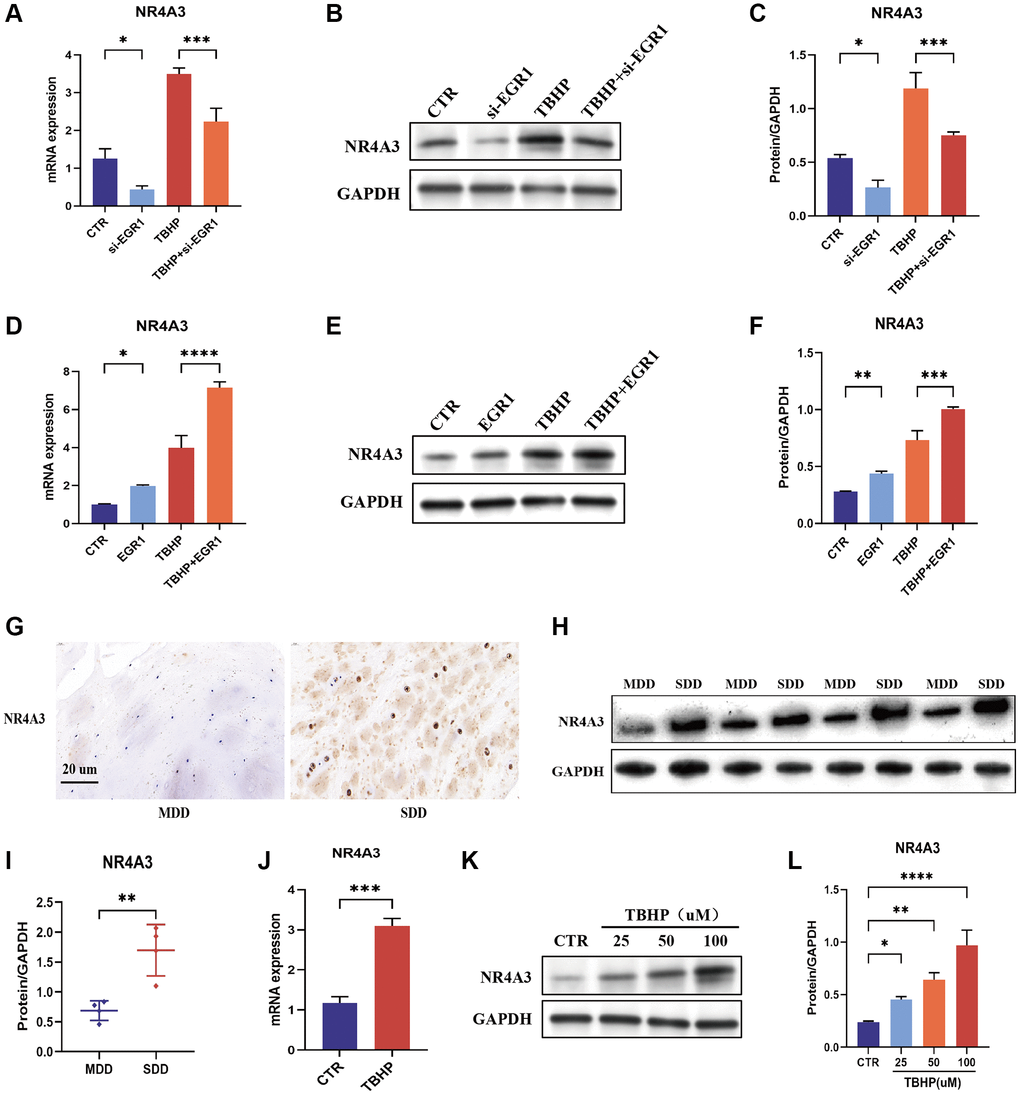 EGR1 positively regulates the expression of NR4A3. (A–C) NPCs were transfected with 25 nM Control siRNA or EGR1 siRNA-1 for 24 hours and then treated with 50 μM TBHP for 24 hours before protein or mRNA extraction. The mRNA and protein expression levels of NR4A3 were determined by qRT-PCR and Western blotting. (D–F) NPCs were transfected with 5 μg of the EGR1 expression plasmid or its control vector for 24 hours and then treated with 50 μM TBHP for 24 hours before protein or mRNA extraction. The mRNA and protein expression of NR4A3 was determined by qRT-PCR and Western blotting. (G) The expression of NR4A3 in SDD and MDD patients was examined by IHC staining. (H) The protein expression of NR4A3 in SDD and MDD was examined by Western blotting. (I) Quantitative analysis of NR4A3 protein level in SDD and MDD. (J) The mRNA expression of NR4A3 in TBHP-treated NPCs was examined by qRT-PCR. (K) NPCs were treated with 0, 25, 50, or 100 μM TBHP for 24 h, after which the protein was extracted, and the NR4A3 expression level was determined by Western blotting. (L) Quantitative analysis of the NR4A3 protein level. *p **p ***p ****p 