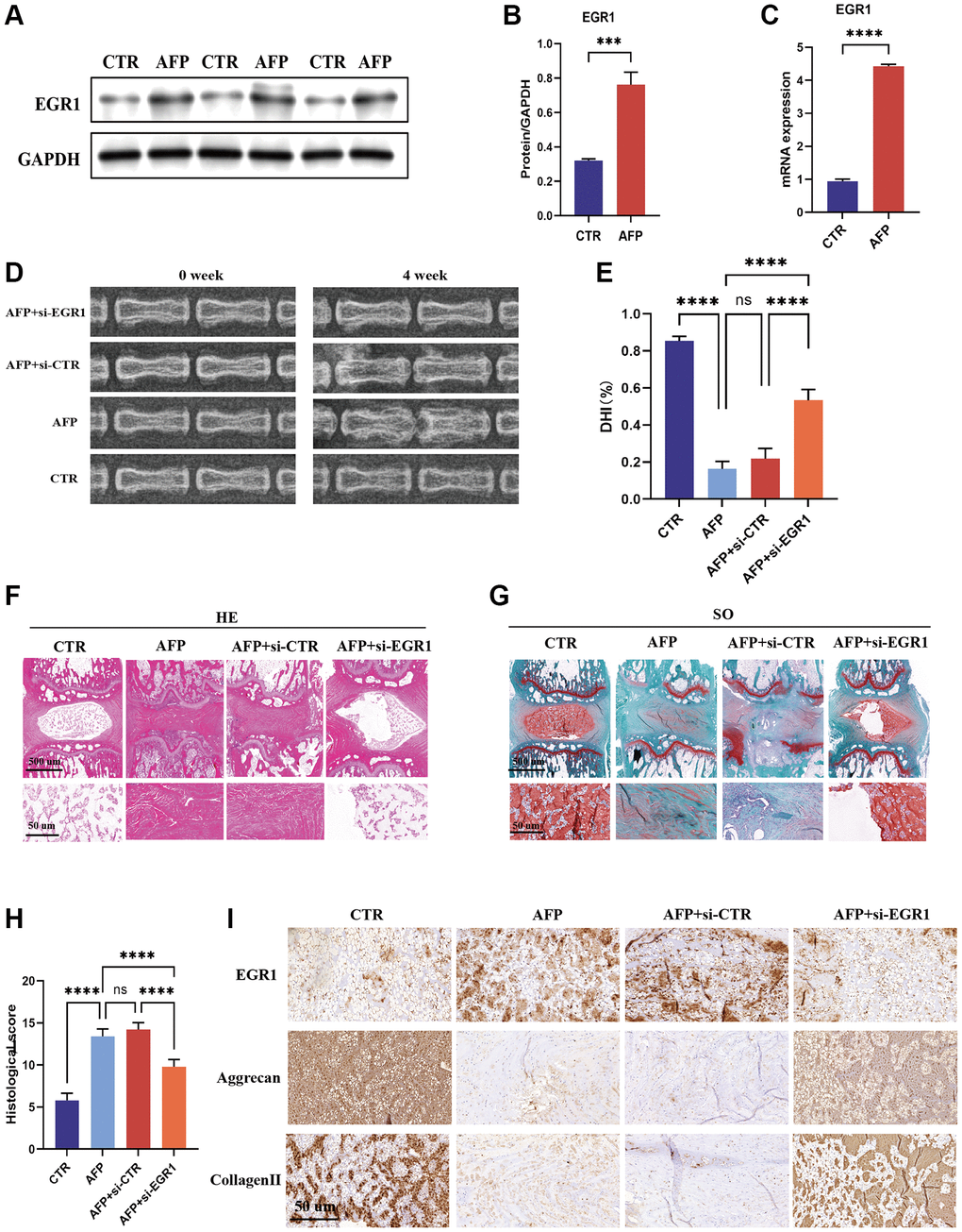 EGR1 siRNA alleviates the progression of IVDD in the AFP-treated rat model. (A) The protein expression of EGR1 in the IVDD rat model was determined by western blotting. (B) Quantitative analysis of EGR1 levels. (C) EGR1 mRNA expression in the IVDD rat model was examined by qRT-PCR. (D) X-ray images of the different groups before and 4 weeks after puncture. (E) Changes in intervertebral disc height were evaluated. (F, G) Representative images of HE and safranin-O staining in the four groups. (H) Histological scores were calculated. (I) Immunohistochemical staining of EGR1, aggrecan, and collagen II. ***p ****p 