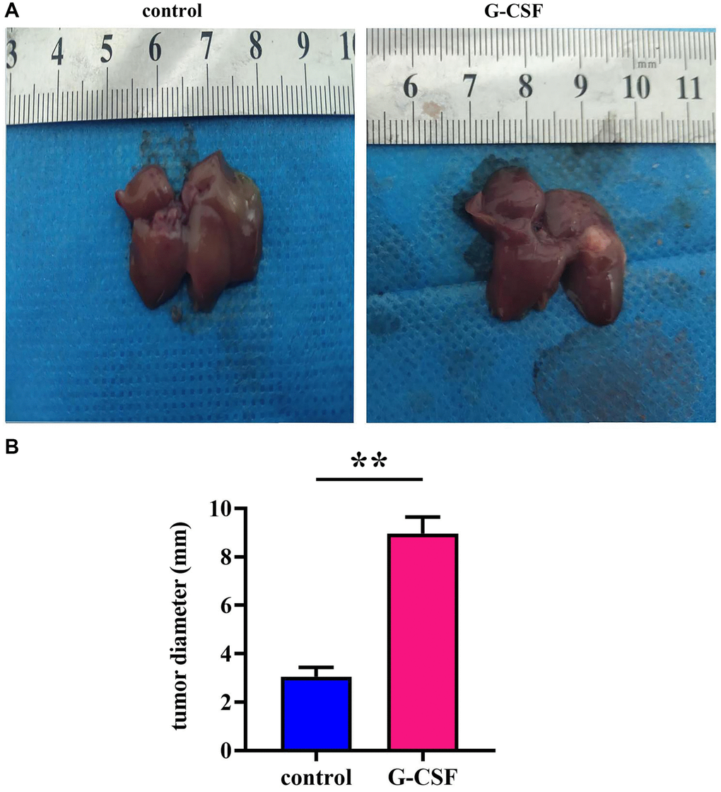Neoplastic engraftment experimentation in athymic rodents. (A) Observations of intrinsically engrafted neoplasms in murine models. (B) Quantitative analyses of neoplastic diameters. The P-value is less than 0.05.