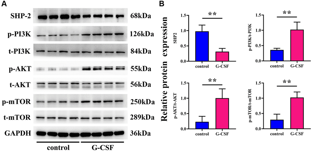Profiling of G-CSF, VEGF, TGF-β, and MMPs expression levels via western blotting techniques. (A) Protein bands indicative of G-CSF, VEGF, TGF-β, and MMPs presence. (B) Comparative proteinic expression levels of G-CSF, VEGF, TGF-β, and MMPs. The P-value is less than 0.05.
