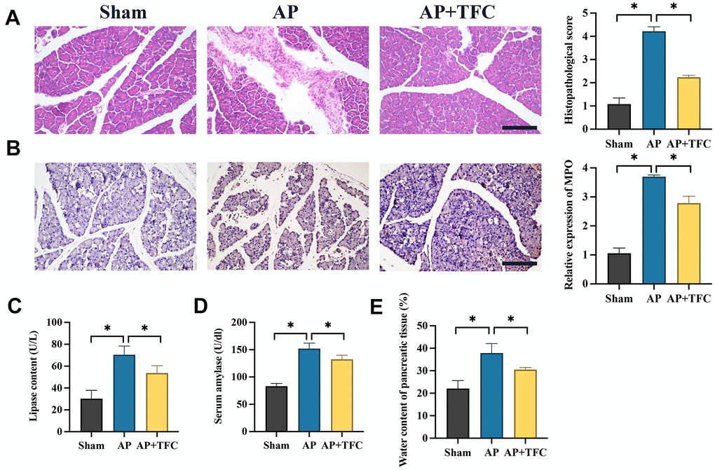 Inhibition of AP in vivo was achieved by TFC. (A) HE staining was performed to observe pancreatic tissue injury (Magnification 200X); (B) The level of MPO was measured with IHC staining (Magnification 200X); (C, D) The levels of lipase content and serum amylase were measured; (E) The water content of pancreatic tissue was calculated. * indicates p