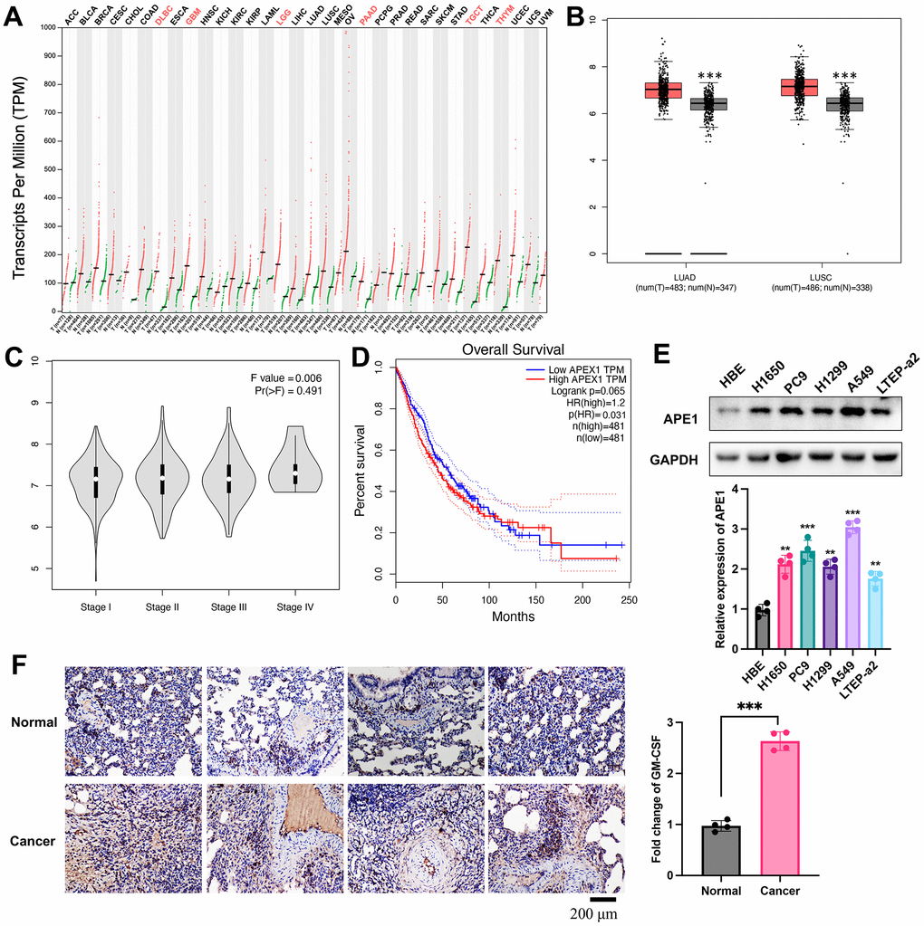 Differential expression of APE1 in lung cancer. (A, B) Analysis of APE1 expression in various tumor types and normal tissues using GEPIA and TCGA databases. (C, D) Negative correlation of decreased APE1 expression with tumor stage and positive correlation with higher survival rate based on GEPIA analysis. (E, F) APE1 expression in cancer cells and tissues measured by Western blotting and IHC staining. **p 