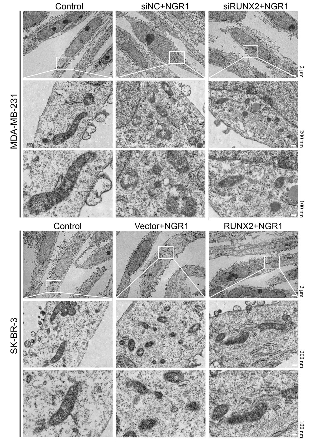 NGR1 disrupts mitochondrial morphology in breast cancer cells by down-regulating RUNX2. The mitochondrial structure of breast cancer cells was observed by electron microscopy after transfection of siRNA in breast cancer MDA-MB-231 for 48 h, transfection of overexpression plasmid in SK-BR-3 for 48 h, and then NRG1 treatment for 48 h.