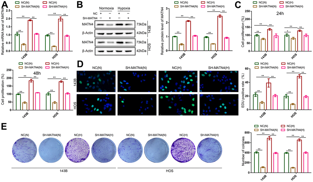 Inhibition of MATN4 significantly reversed the promoting effects of hypoxia on the proliferation ability of OS cells. (A, B) RT-qPCR and western blotting were used to detect mRNA and protein expression of MATN4 in OS cells transfected with sh-scramble or SH-MATN4 under normoxia and hypoxia. (C, D) CCK-8 and EDU assays were used to detect the proliferation ability of OS cells transfected with sh-scramble or SH-MATN4 at 24h and 48h under normoxia and hypoxia. (E) Colony formation assays were used to detect the colony formation ability of OS cells transfected with sh-scramble or SH-MATN4 at 24h and 48h under normoxia and hypoxia. *, p 