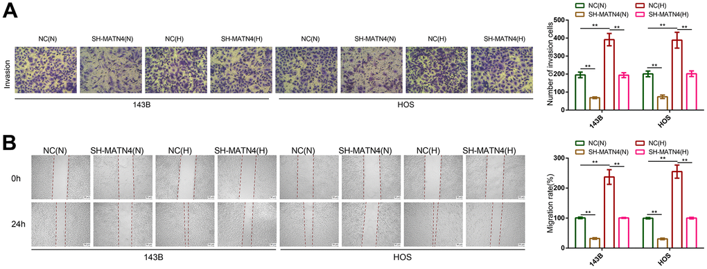 Inhibition of MATN4 significantly reversed the promoting effects of hypoxia on the migration and invasion abilities of OS cells. (A) Transwell assays were used to detect the invasion ability of OS cells transfected with sh-scramble or SH-MATN4 under normoxia and hypoxia. (B) Wound healing assays were used to detect the invasion ability of OS cells transfected with sh-scramble or SH-MATN4 under normoxia and hypoxia. *, p 
