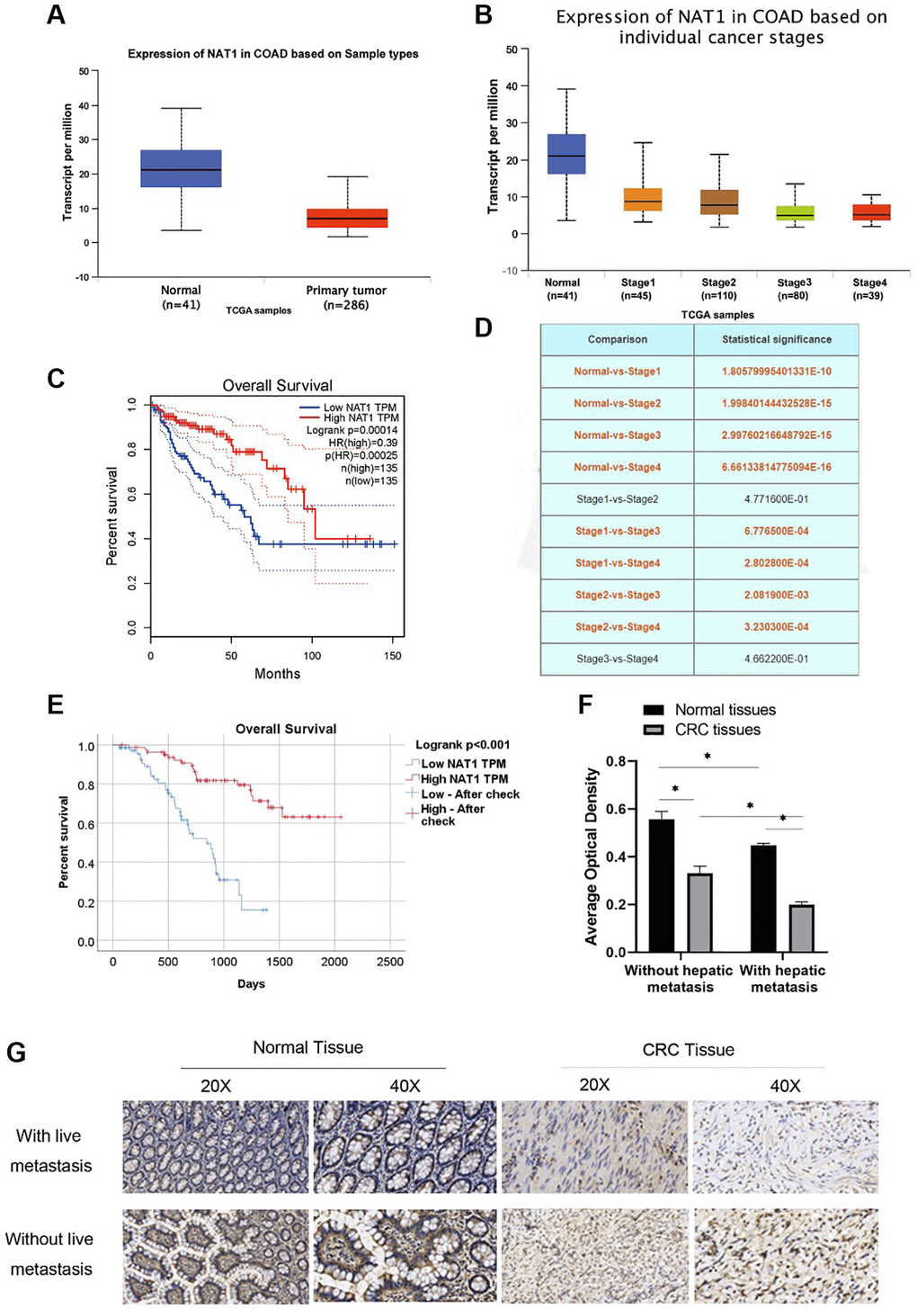 NAT1 has low expression in patients with colorectal cancer and patients with liver metastasis. (A) TCGA database showed that the expression level of NAT1 was low in patients with colorectal cancer; (B) The expression of NAT1 was lower in colorectal cancer patients with higher stage; (C) Overall survival was longer in patients with high NAT1 expression; (D) NAT1 was statistically different in different stages of colorectal cancer; (E) Immunohistochemical results of tissue chips showed that patients with higher NAT1 expression had longer survival; (F, G) Immunohistochemical results showed that the level of NAT1 in colon cancer tissues of patients with liver metastasis was lower (P 
