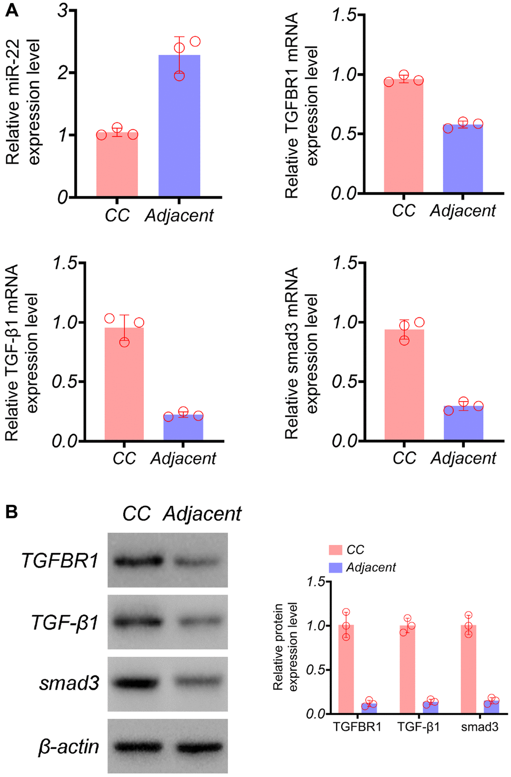 The effects of overexpression of TGFBR1 to overexpression of miR-22 on the RNA and protein expression of TGFBR1, TGF-β1, and Smad3. (A) RT-PCR. (B) Western blot.