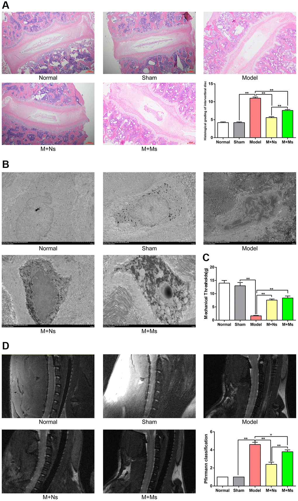 The therapy of Ns affected intervertebral disc degeneration in the intervertebral disc of CS rats. (A) H&E staining of cervical intervertebral disc in different groups 4 weeks after intervening, note: scale bar = 100 um. (B) Transmission electron microscope of the nucleus pulposus in different groups 4 weeks after intervening, note: scale bar = 2 um. (C) The neck-skin response thresholds to the mechanical stimuli applied by von Frey filaments in different groups 4 weeks after intervening. (D) Pfirrmann MRI Grades in different groups 4 weeks after intervening. Note: values are means ± SEMs, n = 5 per group, *p **p 