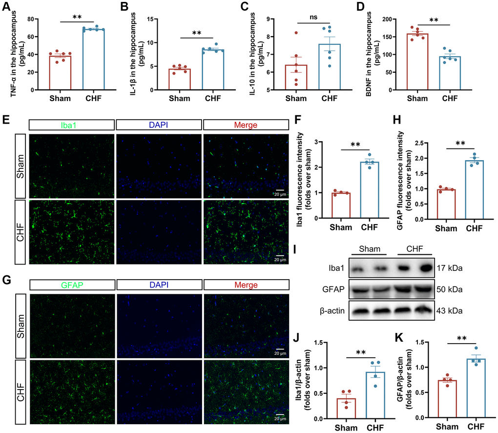 CHF triggers the inflammatory responses via the activation of microglia and astrocytes. (A–D) The content of TNF-α (A), IL-1β (B), IL-10 (C), and BDNF (D) in the hippocampus was detected by ELISA n = 6. (E, F) Iba1 immunofluorescence staining in the hippocampus and their quantitative analysis. Green: Iba1; Blue: DAPI. Scale bars: 20 μm n = 4. (G, H) GFAP immunofluorescence staining in the hippocampus and their quantitative analysis. Green: GFAP; Blue: DAPI. Scale bars: 20 μm n = 4. (I–K) Representative Western blots (I) and quantification data of Iba1 (J) and GFAP (K). β-actin was used as a loading control. Data are presented as the Mean ± SEM; *P **P n = 3.