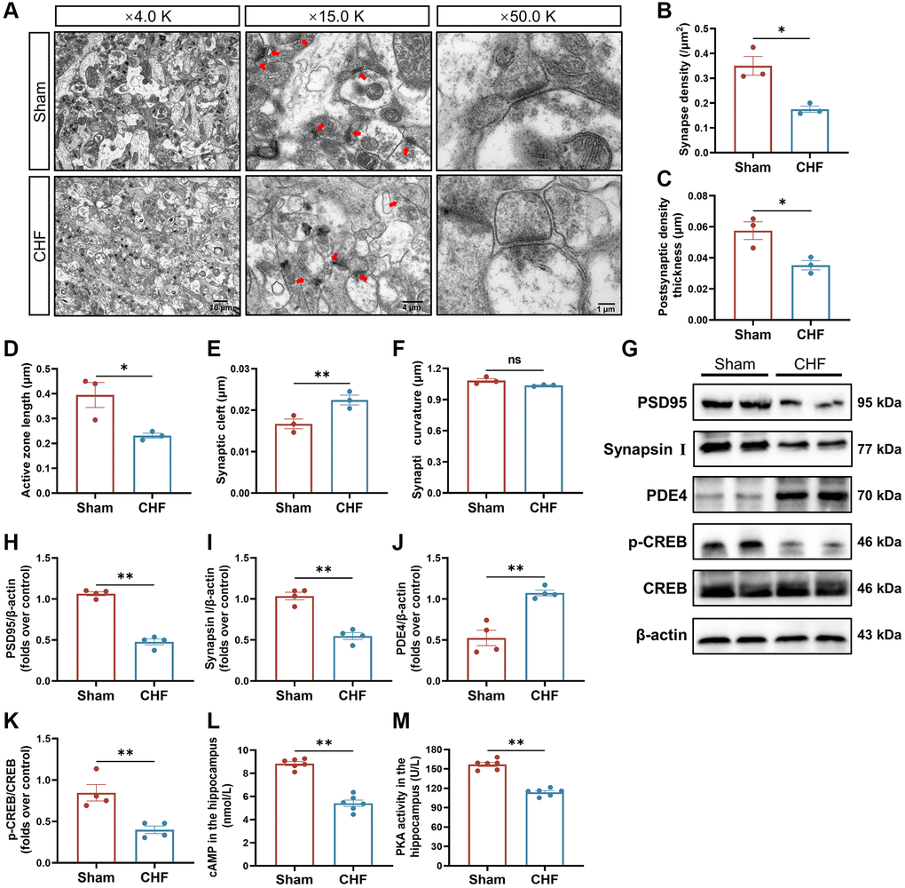 CHF impairs synaptic ultrastructure in the hippocampus. (A) Representative ultrastructural images of synapses shown at magnifications of × 4000, scale bars: 10 μm; × 15000, scale bars: 4 μm; × 50000, scale bars: 1 μm, respectively. (B–F) Quantifications of the synaptic interface, including synapse density (B), PSD thickness (C), active zone length (D), synaptic cleft (E), and synaptic curvature (F) n = 3. (G–K) Representative Western blots (G) and quantitative data of PSD95 (H), Synapsin I (I), PDE4 (J), p-CREB and CREB (K). β-actin was used as a loading control n = 3. (L) The content of cAMP in the hippocampus detected by ELISA. (M) The activity of PKA in the hippocampus detected by ELISA n = 6. Data are presented as the Mean ± SEM; *P **P 