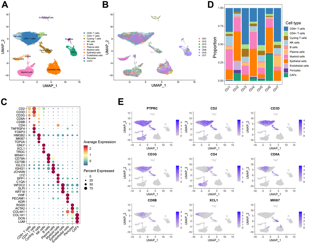 Interrogating the cellular constitution of ovarian cancer at single-cell resolution. (A, B) UMAP plot showing the major cell subpopulations in ovarian cancer. (C) Bubble heatmap showing expression levels of selected signature genes in ovarian cancer. Dot size indicates fraction of expressing cells, colored based on normalized expression levels. (D) Relative proportions of diverse cell types across each sample. (E) Feature plots to further identify various immune cells, based on the expression levels of marker genes.