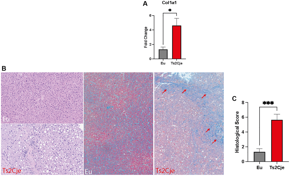 DS mice show a marked increase in fibrotic markers. (A) Col1a1 expression level is increased in Ts2Cje livers. Representative histogram of the real-time PCR against Col1a1 on the liver extract obtained from 12-months old Eu and Ts2Cje mice. GAPDH was used as housekeeping gene. (B) Ts2Cje liver section shows an increased fibrotic level. Representative histological images of the rat livers from control and Ts2Cje group. (Top left panel) Mouse liver from control group showing absence of steatosis (score 0) and mild periportal inflammation (score 1) (hematoxylin and eosin; original magnification 100x). (Bottom left panel) Mouse liver from Ts2Cje group exhibiting moderate steatosis (score 2) and moderate portal inflammation (score 2) (hematoxylin and eosin; original magnification 150x). (Mid panel) Mice liver from control group showing absence of fibrosis (score 0) (Masson’s trichrome; original magnification 50x). (Right panel) Mice liver from Ts2Cje group exhibiting diffuse fibrosis (score 3) with fibrous bridging (arrows) (Masson’s trichrome; original magnification 50x). (C) Histological score quantified as in B. Histograms are representative of four different experiments (*P ≤ 0.05; ***P ≤ 0.001).