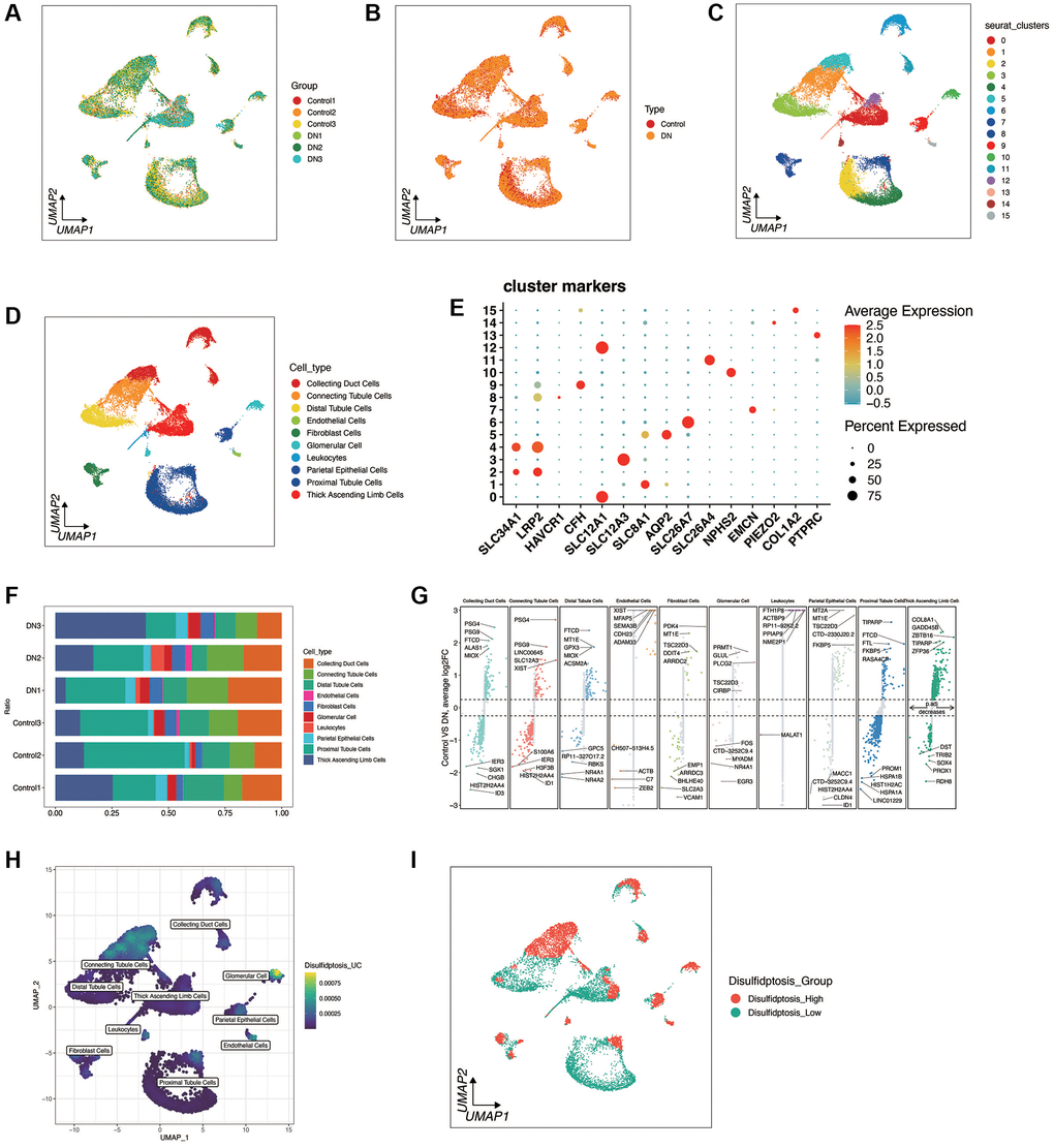 Single-cell sequencing analysis of diabetic nephropathy (DN) and control samples. (A, B) Quality control metrics and sample integration results showing no significant batch effects between DN and control samples, with observed heterogeneity. (C–E) UMAP plots illustrating cell clustering into 16 distinct clusters based on cell type marker genes, with 10 cell types annotated. (F, G) Distribution of cell types across samples and the top 5 significantly up-regulated and down-regulated differential genes for each cell type in DN and control groups. (H, I) Enrichment fraction of disulfidptosis in Glomerular Cells and Connecting Tubule cells, with samples categorized into Disulifidptosis
