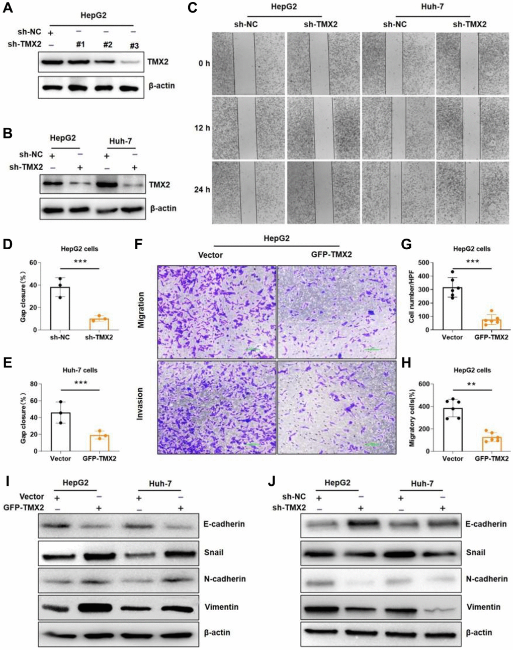 TMX2 promotes epithelial-mesenchymal transition (EMT) in liver cancer cells. Verification of sh-TMX2 (A). Transfection analysis of TMX2 (B). Microscopic observations were recorded at 0, 12, and 24 h after scratching the surface of a confluent layer of the indicated HepG2 and Huh-7 cells (C). Quantitative analysis of wound healing percentage in HepG2 cells (D). Quantitative analysis of wound healing percentage in Huh-7 cells (E). The effects of TMX2 on cell migration and invasion were examined by transwell assays in HepG2 cells (F). Quantitative analysis of cell migration in HepG2 cells (G). Quantitative analysis of cell invasion in HepG-2 cells (H). Western blot analysis of EMT marker expression in TMX2-overexpressing HepG2 and Huh-7 cells (I). Western blot analysis of EMT marker expression in TMX2-deficient HepG2 and Huh-7 cells (J). *p **p ***p 