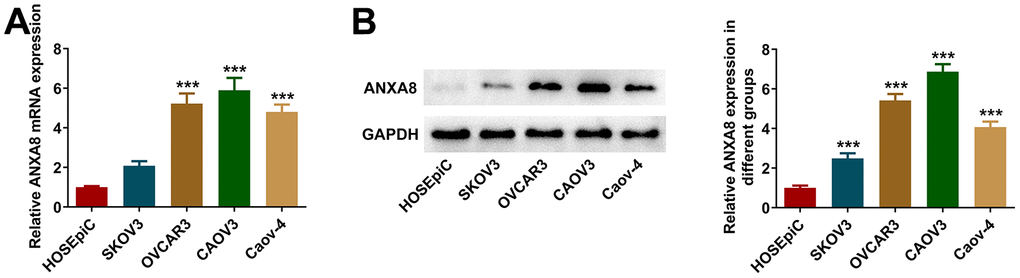 ANXA8 expression was increased in OC cell lines. (A) The expression of ANXA8 in the OC cell line was detected by RT-qPCR; (B) The expression of ANXA8 in the OC cell line was assessed by western blotting. ***P