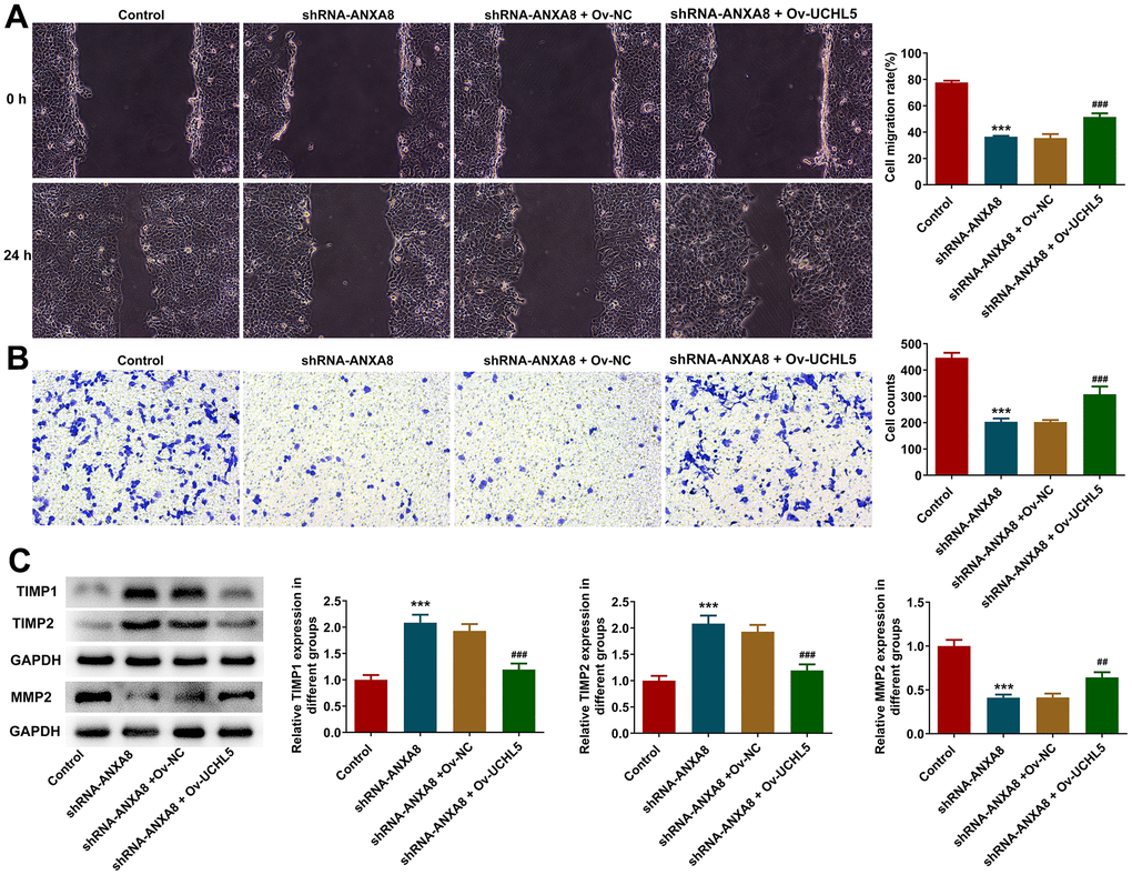 Interference with ANXA8 inhibited the invasion and migration of CAOV3 cells through UCHL5. (A) Wound healing assay was used to detect CAOV3 cell migration ability; (B) Transwell assay was used to detect CAOV3 cell invasion ability; (C) Western blot analysis of the expression of invasion and migration-related proteins TIMP1, TIMP2, and MMP2 in CAOV3 cells. ***P