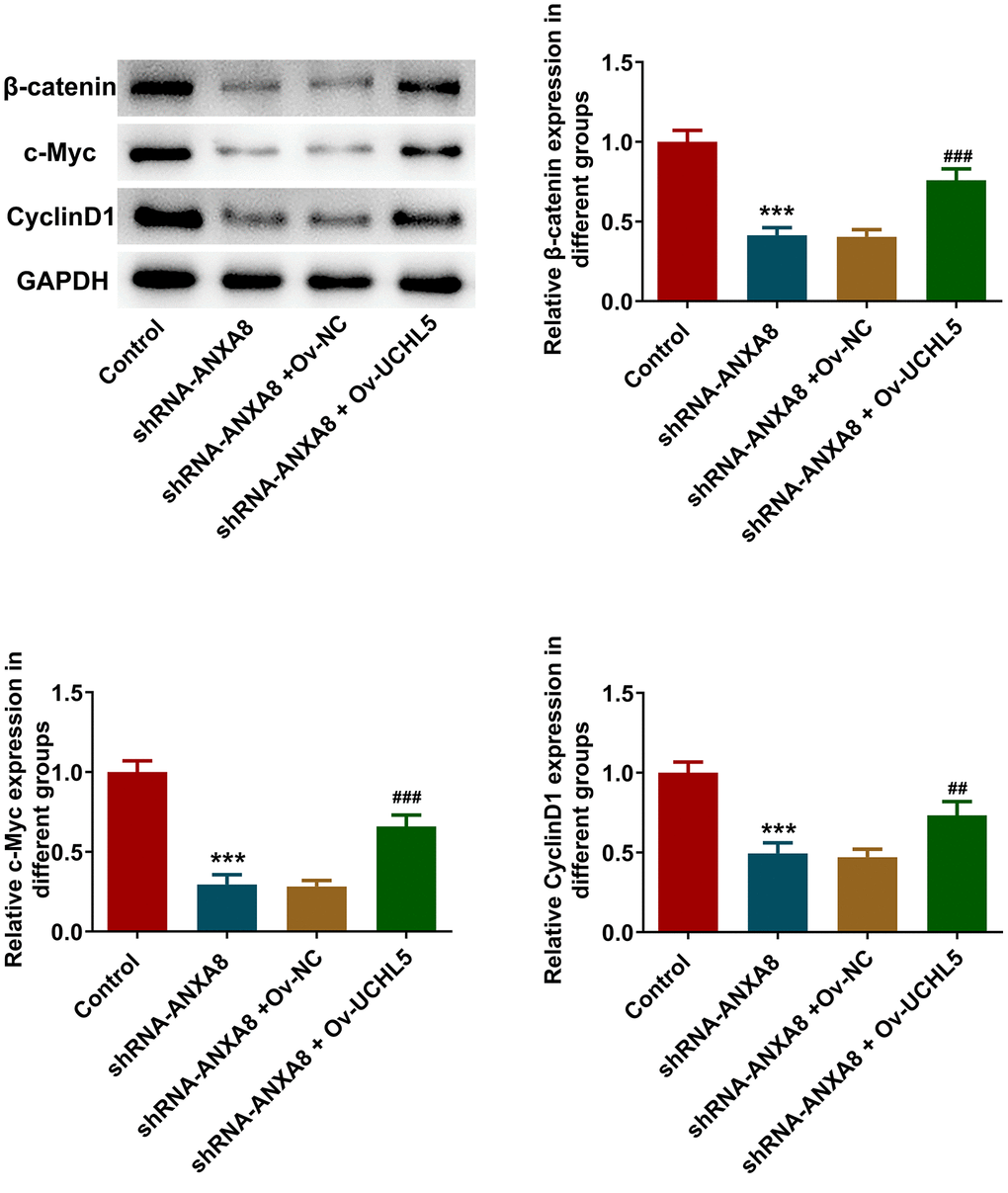 Interference with ANXA8 inhibited the activation of Wnt/β-catenin signaling pathway via UCHL5. Western blot analysis of Wnt/β-catenin signaling pathway-related proteins. ***P